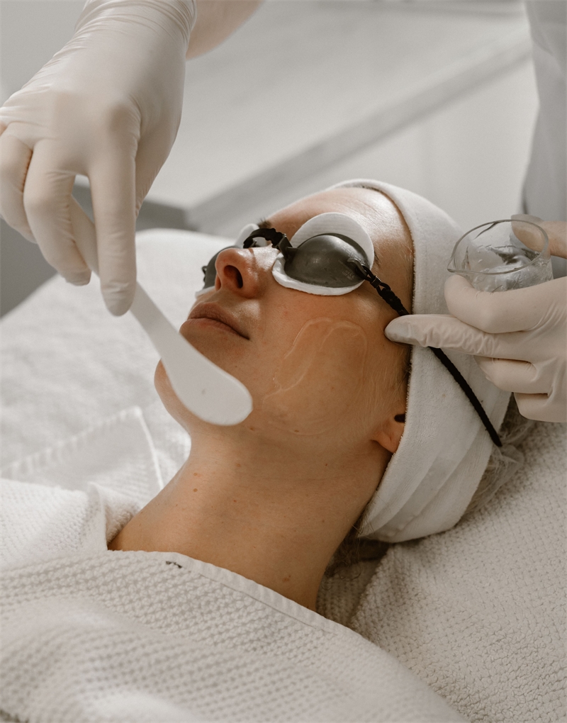 Acne treatment 60 min